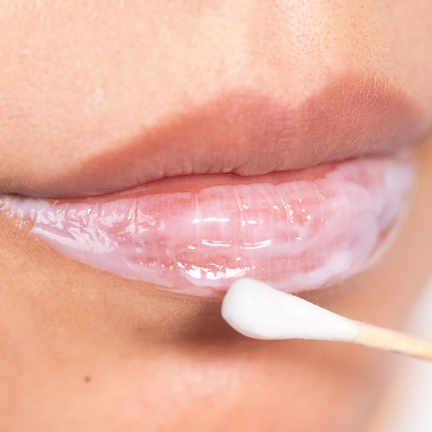 IceCream™ Topical Anesthetic - Image 9